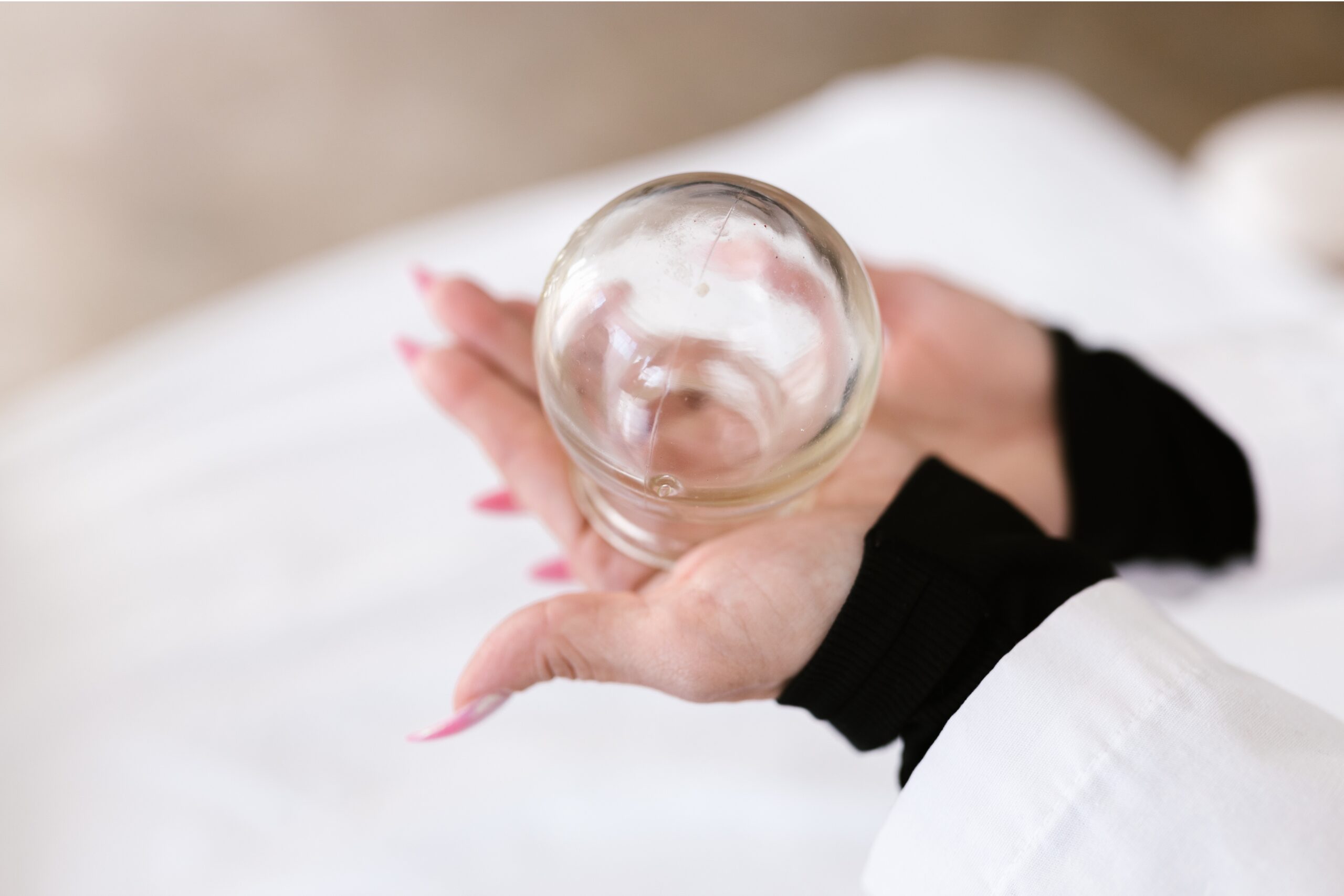 Practitioner holding a glass cupping cup before a dry cupping treatment