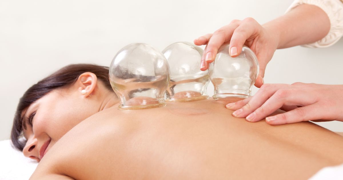Glass cupping therapy cups being applied to a patient's back